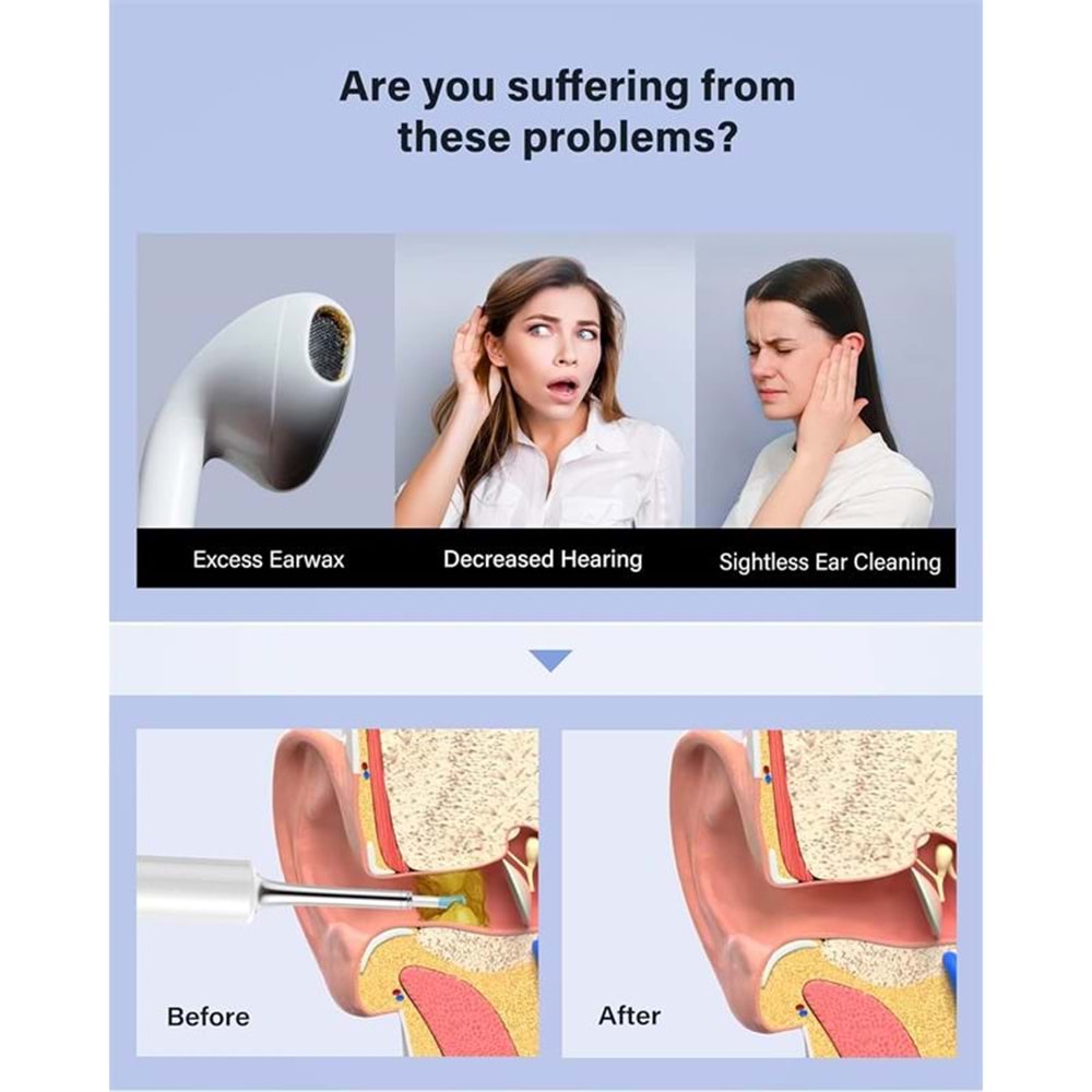 BEBIRD T5 3MP KAMERA 3.5MM LENS ŞARJLI WIFI GÖRÜNTÜLÜ KULAK TEMİZLEYİCİ BEYAZ RENK 