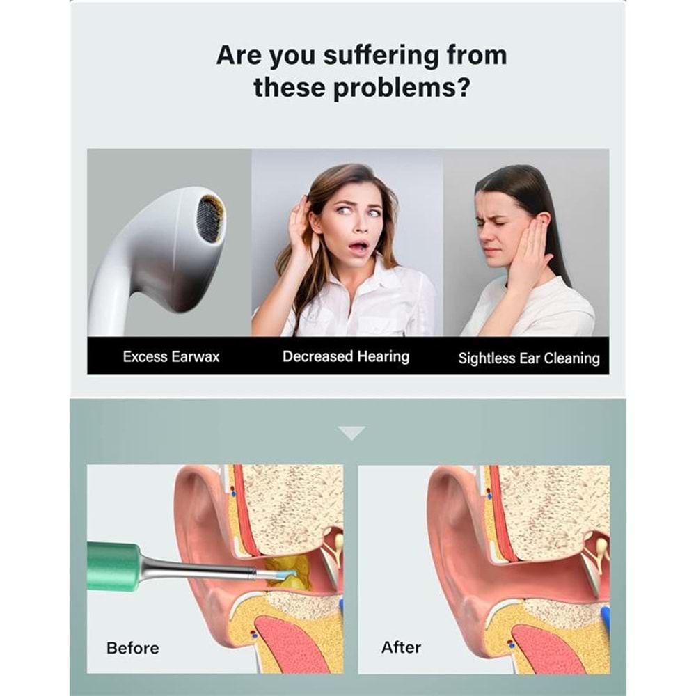 BEBIRD T5 3MP KAMERA 3.5MM LENS ŞARJLI WIFI GÖRÜNTÜLÜ KULAK TEMİZLEYİCİ YEŞİL RENK 