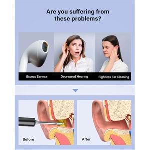 BEBIRD T5 3MP KAMERA 3.5MM LENS ŞARJLI WIFI GÖRÜNTÜLÜ KULAK TEMİZLEYİCİ SİYAH RENK 