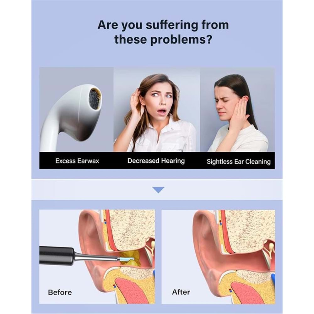 BEBIRD T5 3MP KAMERA 3.5MM LENS ŞARJLI WIFI GÖRÜNTÜLÜ KULAK TEMİZLEYİCİ SİYAH RENK 