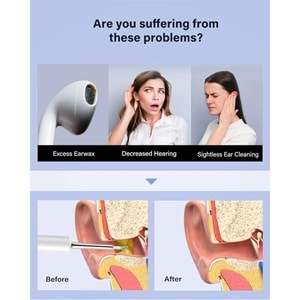 BEBIRD T5 3MP KAMERA 3.5MM LENS ŞARJLI WIFI GÖRÜNTÜLÜ KULAK TEMİZLEYİCİ BEYAZ RENK 